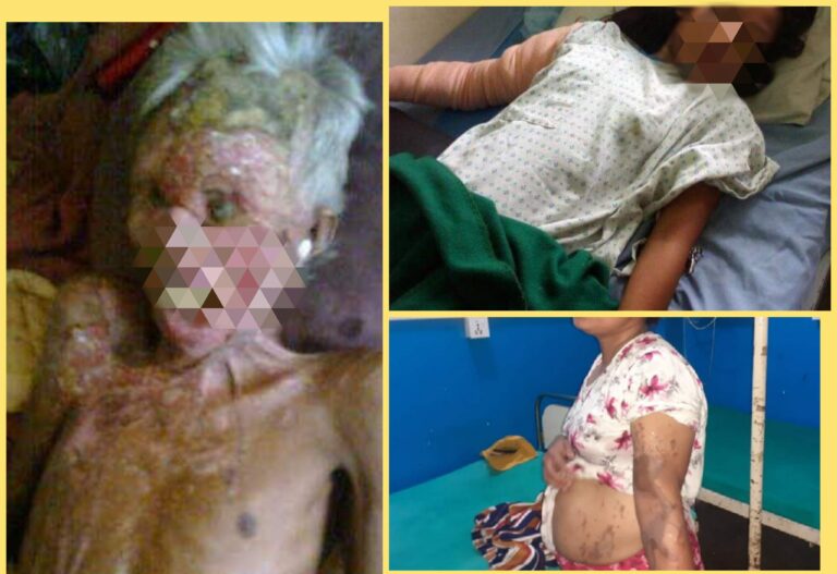 रौतहटमा  अनुमती नलिइ एसिड बिक्री